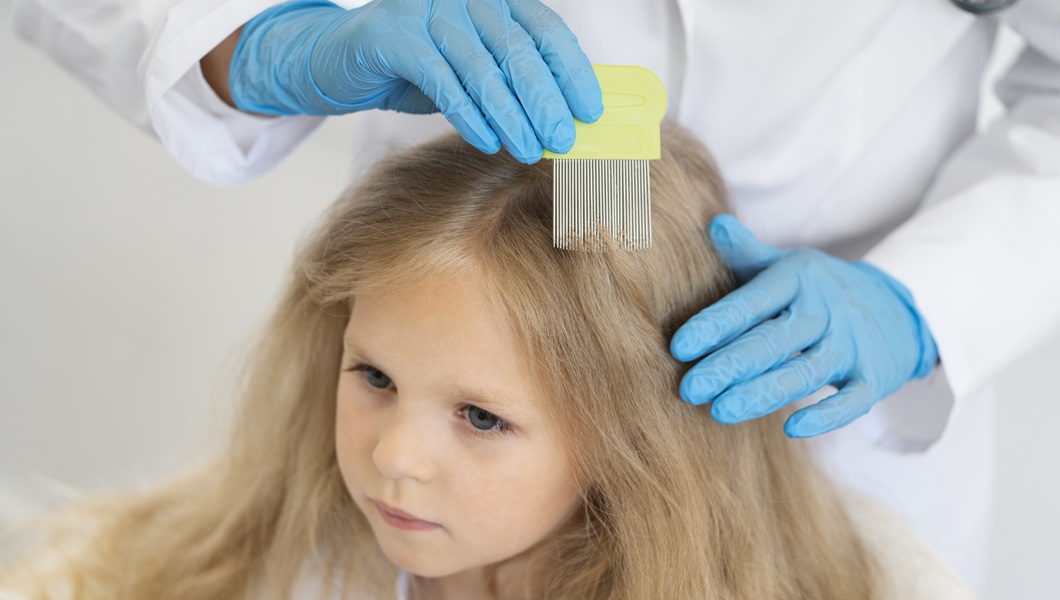 high-angle-doctor-helping-girl-with-lices-1