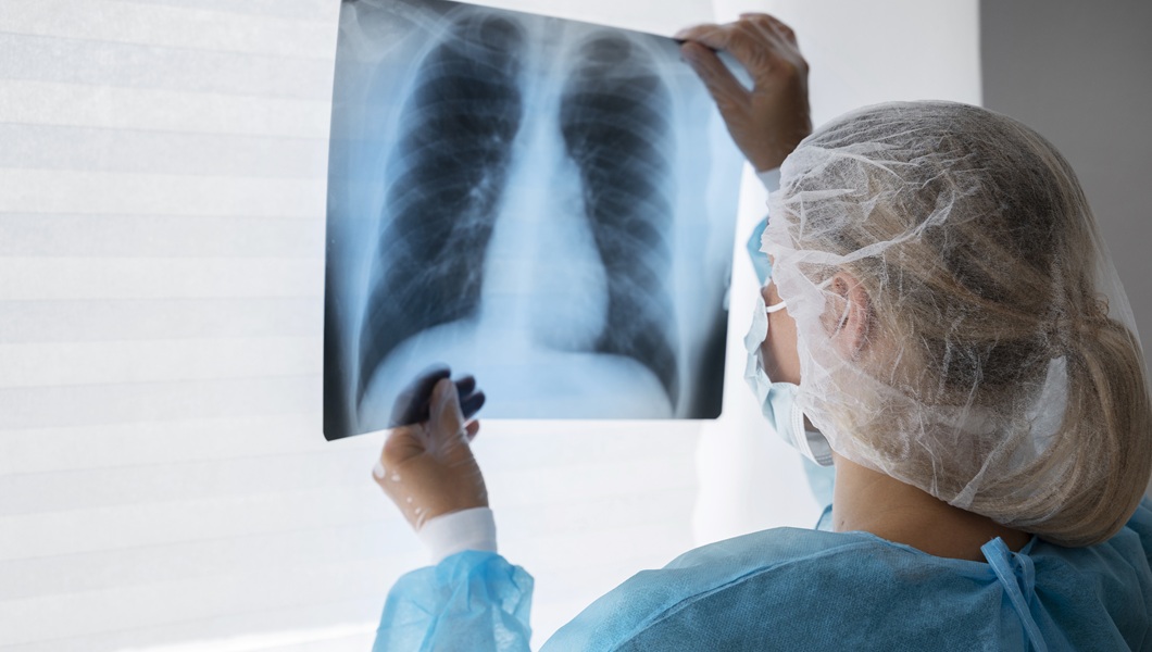 vrac-vid-sboku-proveraet-rentgenografiu